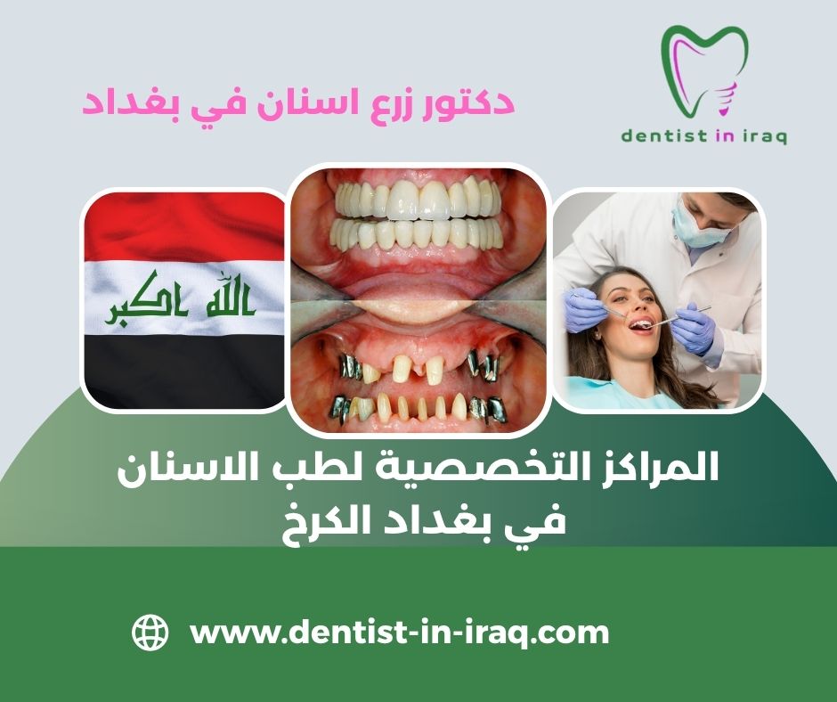 المراكز التخصصية لطب الاسنان في بغداد
