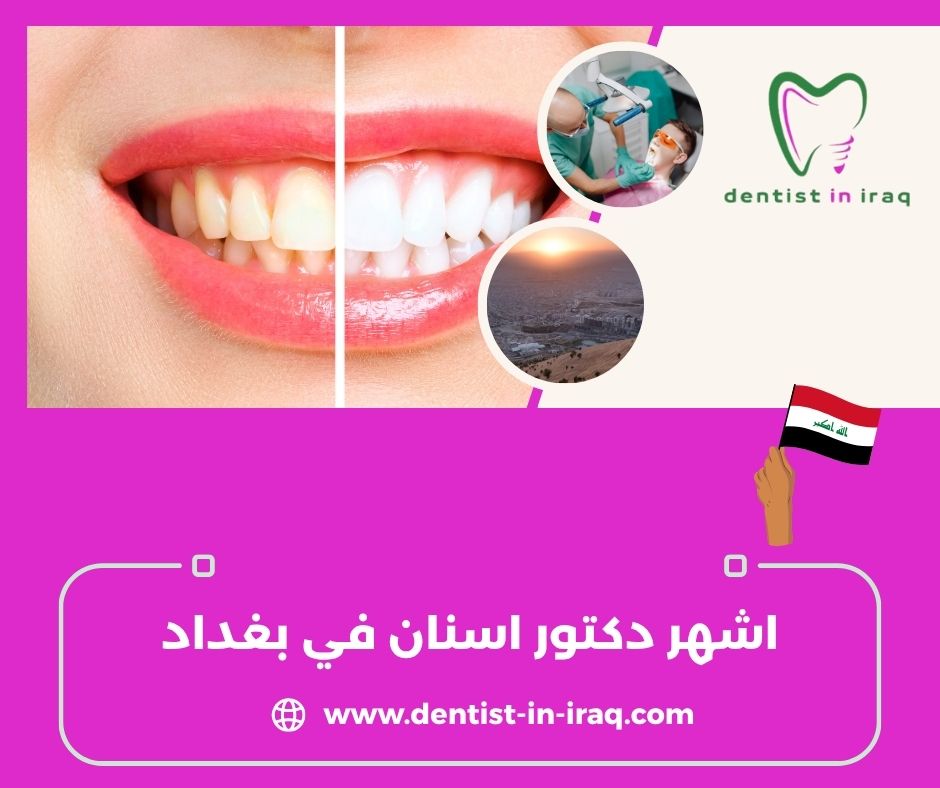 اشهر دكتور اسنان في بغداد