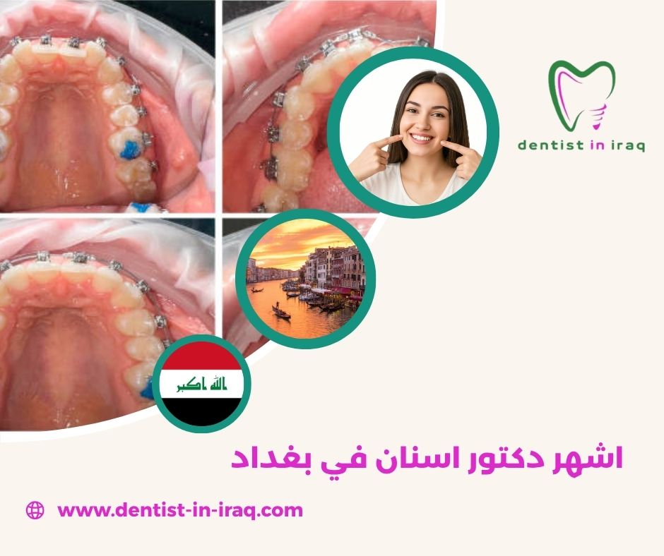 اشهر دكتور اسنان في بغداد اشهر دكتور اسنان في بغداد