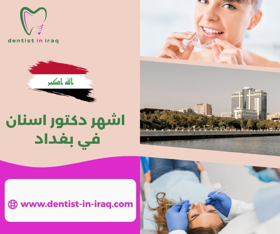 سعر الحشوة الضوئية في العراق سعر الحشوة الضوئية في العراق