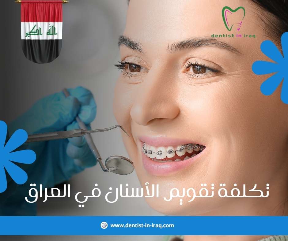 تكلفة تقويم الأسنان في العراق