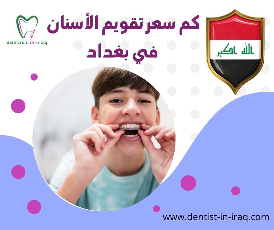كم سعر تقويم الأسنان في بغداد