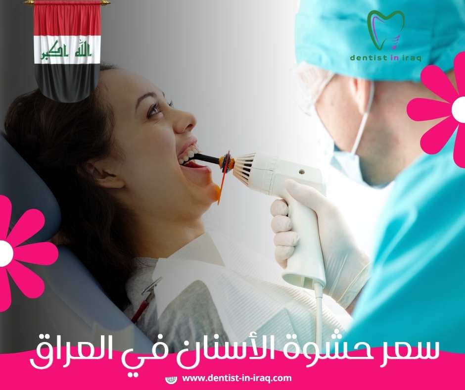 سعر حشوة الأسنان في العراق