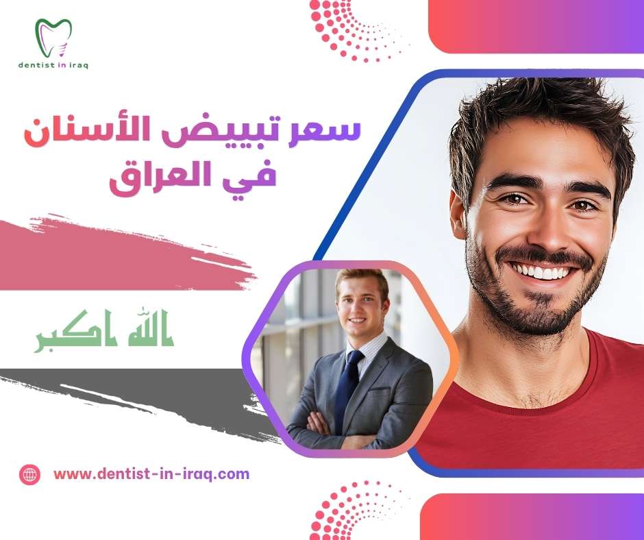 سعر تبييض الأسنان في العراق
