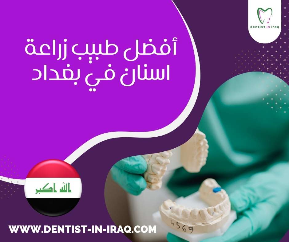 أفضل طبيب زراعة أسنان في بغداد