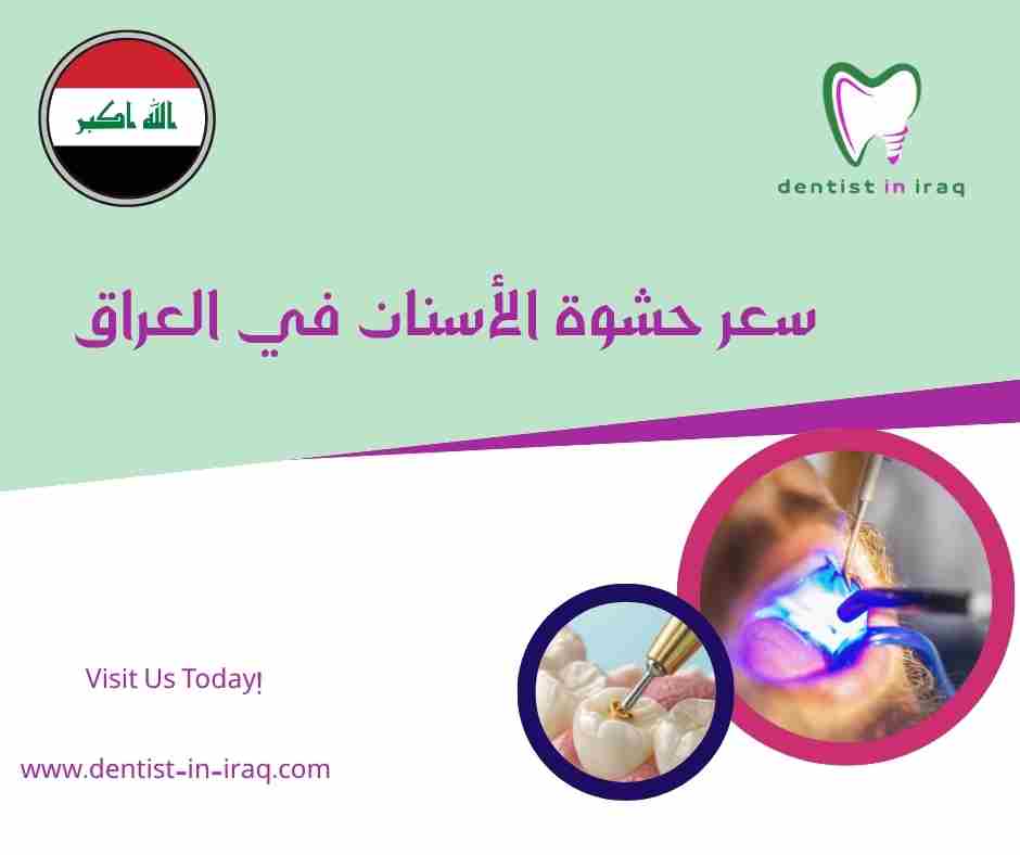 سعر حشوة الأسنان في العراق
