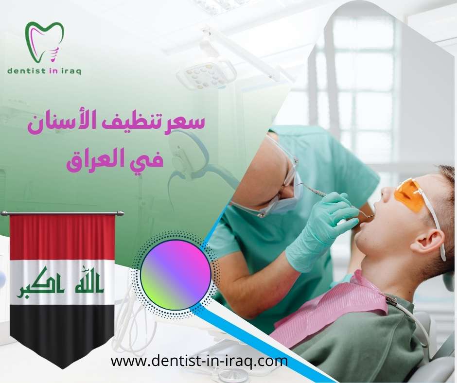 سعر تنظيف الأسنان في العراق