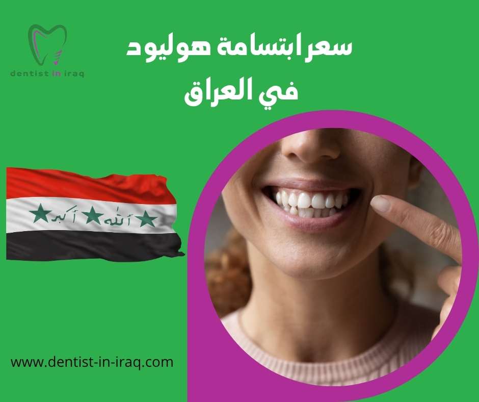 سعر ابتسامة هوليود في العراق
