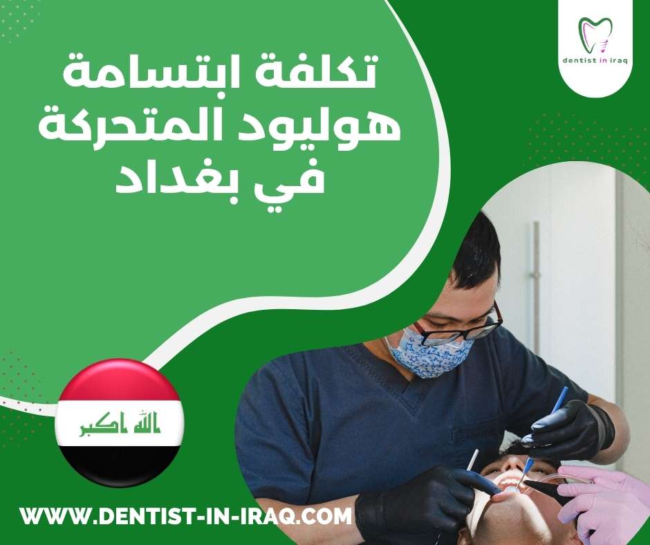 تكلفة ابتسامة هوليود المتحركة في بغداد
