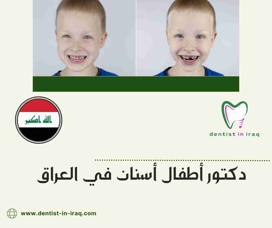 دكتور أطفال أسنان في العراق