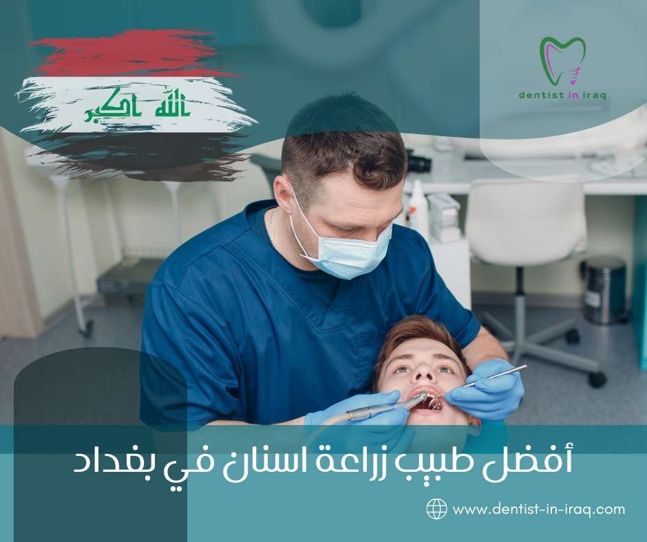أفضل طبيب زراعة أسنان في بغداد