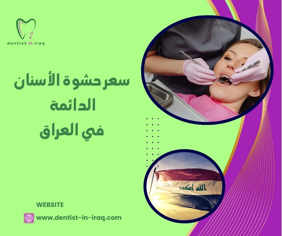 سعر حشوة الأسنان الدائمة في العراق