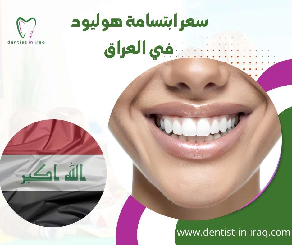 سعر ابتسامة هوليود في العراق