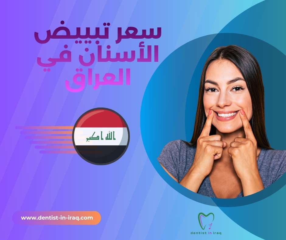 سعر تبييض الأسنان في العراق