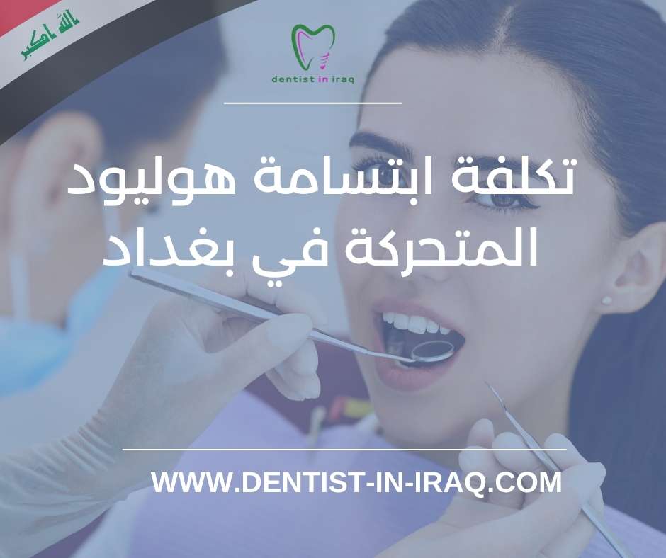 تكلفة ابتسامة هوليود المتحركة في بغداد