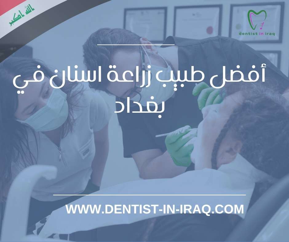 أفضل طبيب زراعة أسنان في بغداد