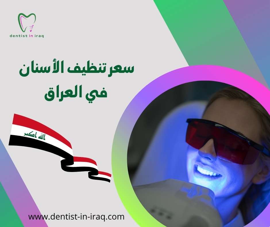 سعر تنظيف الأسنان في العراق