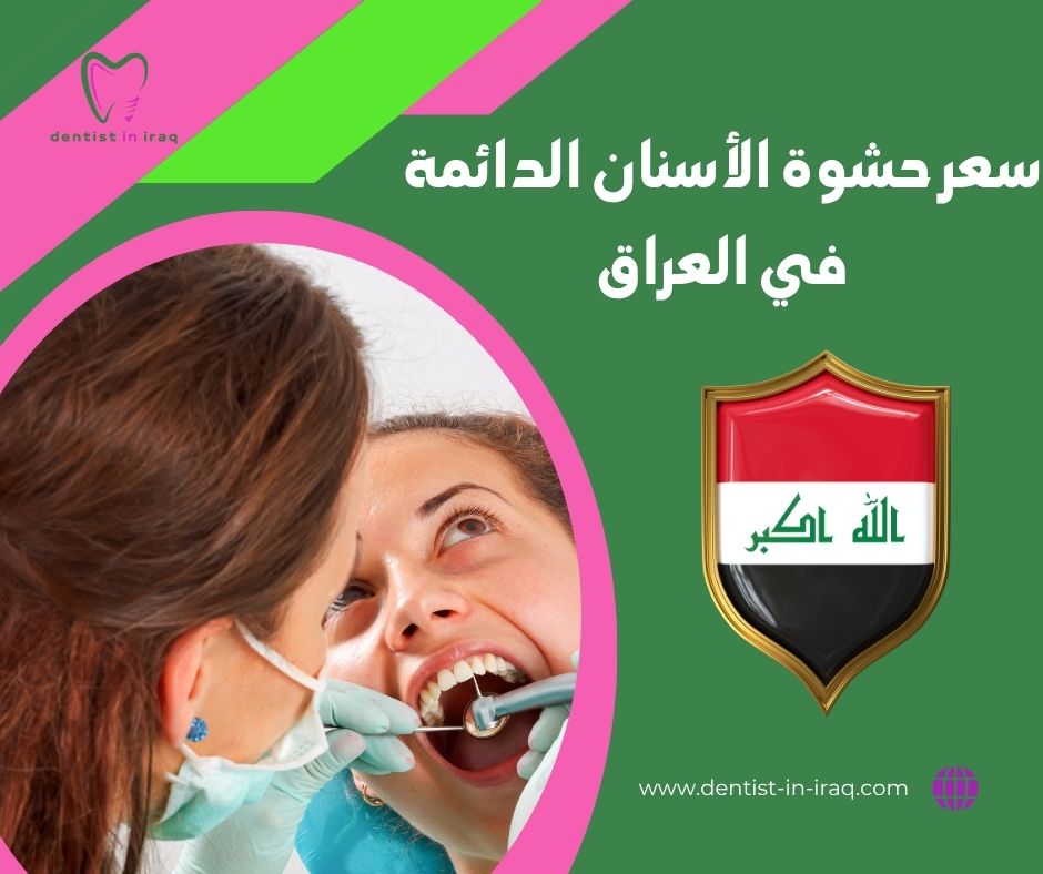 سعر حشوة الأسنان الدائمة في العراق