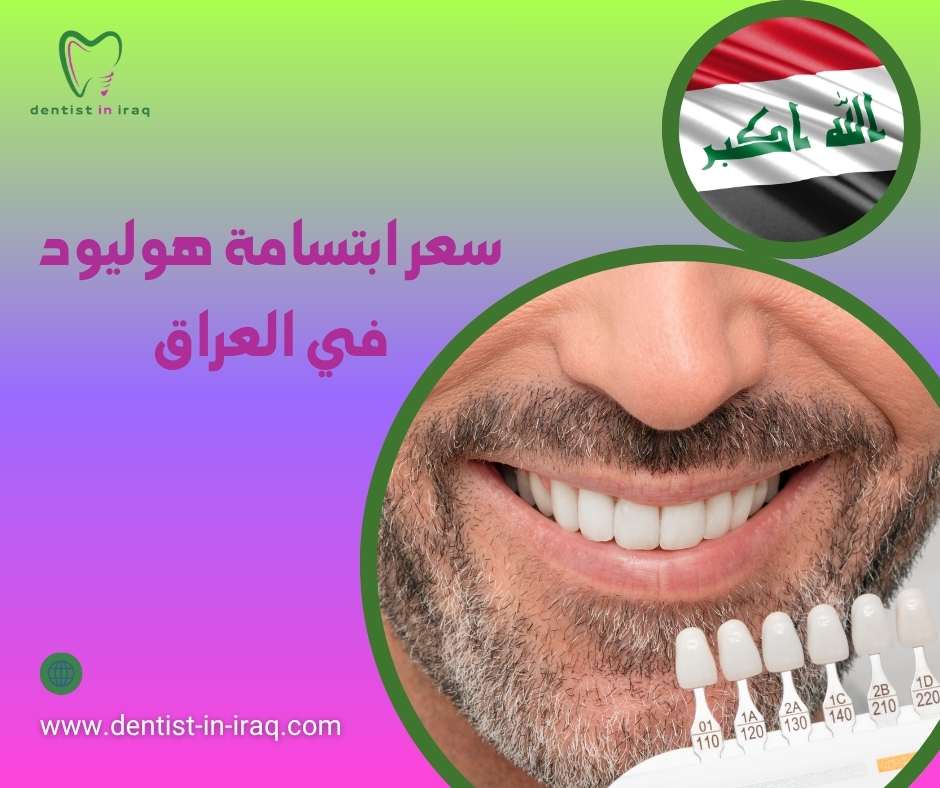 سعر ابتسامة هوليود في العراق