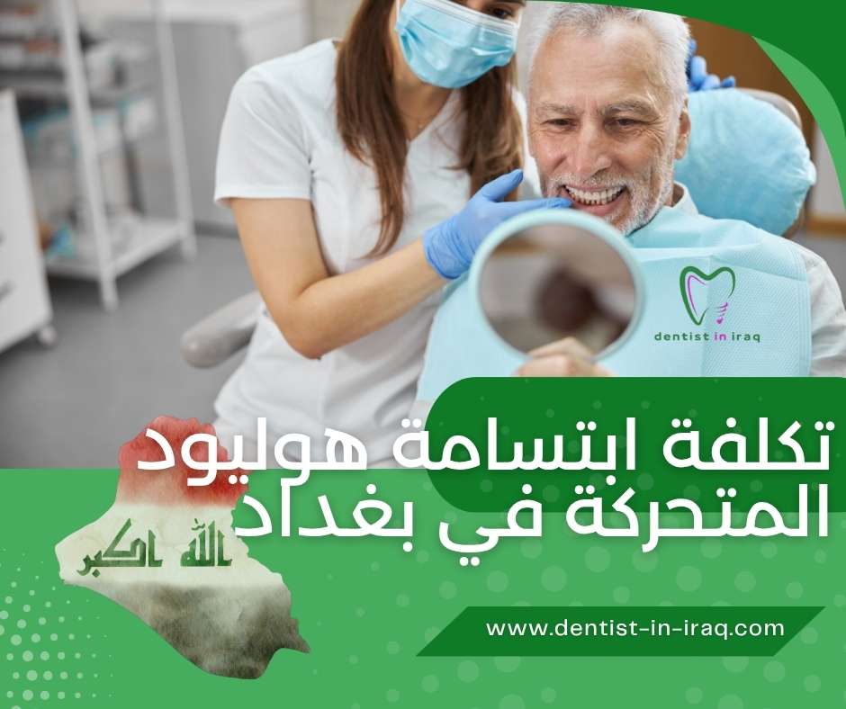 تكلفة ابتسامة هوليود المتحركة في بغداد