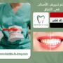 سعر تبييض الأسنان في العراق