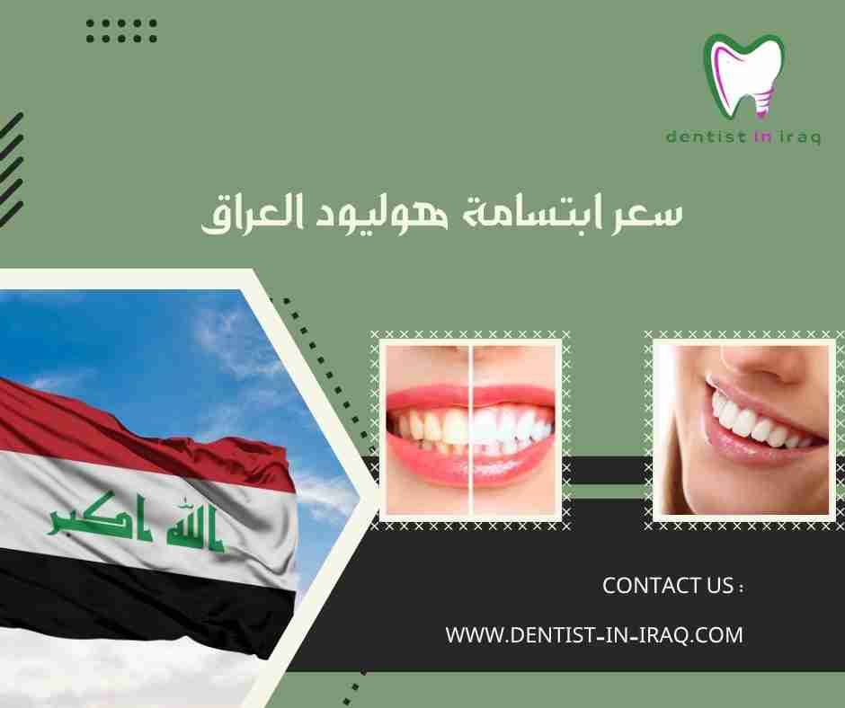 سعر ابتسامة هوليود العراق