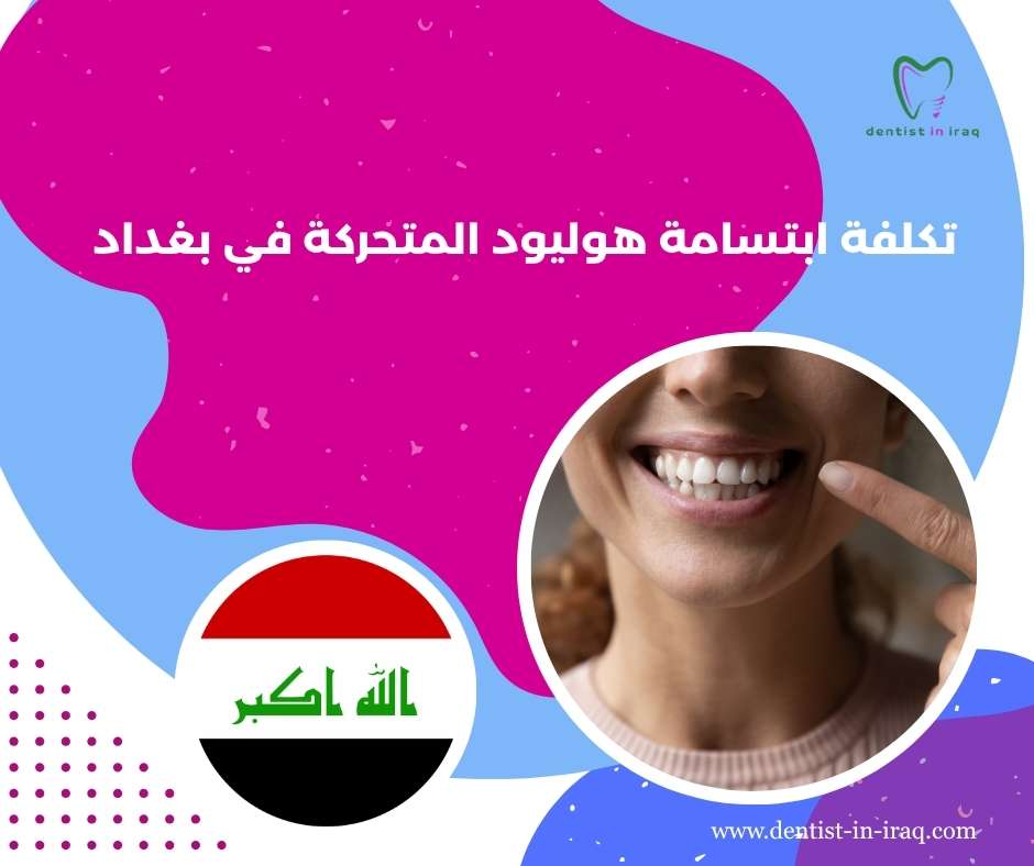 تكلفة ابتسامة هوليود المتحركة في بغداد