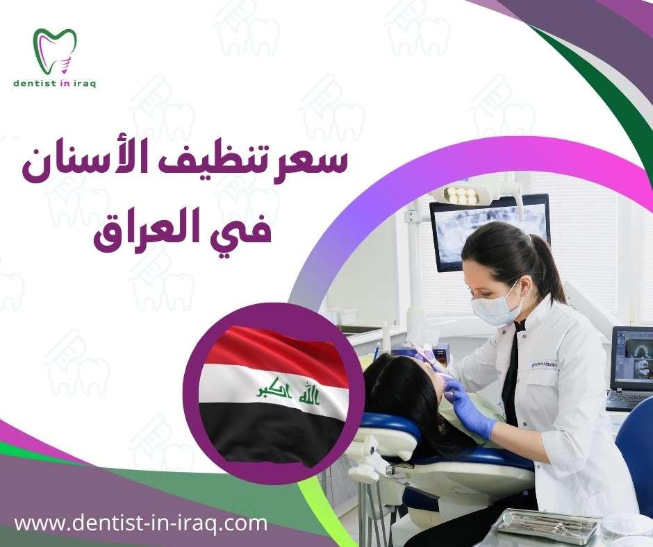 سعر تنظيف الأسنان في العراق