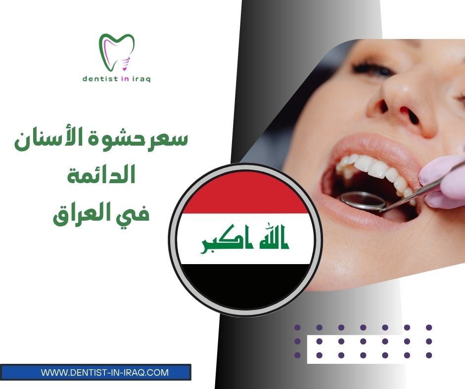 سعر حشوة الأسنان الدائمة في العراق