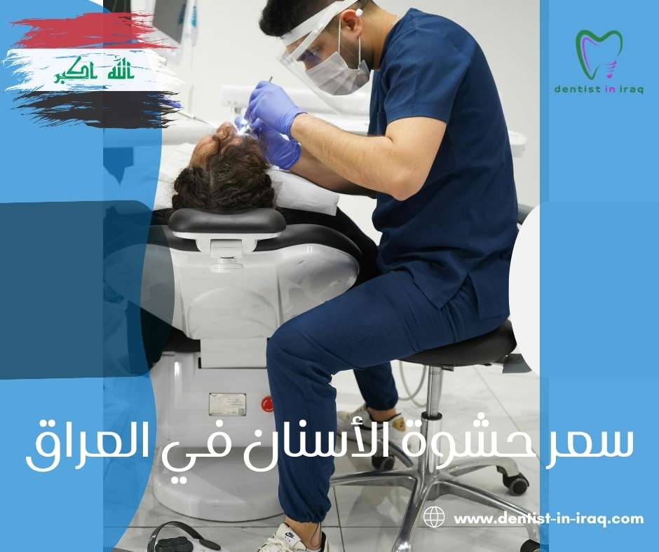 سعر حشوة الأسنان في العراق