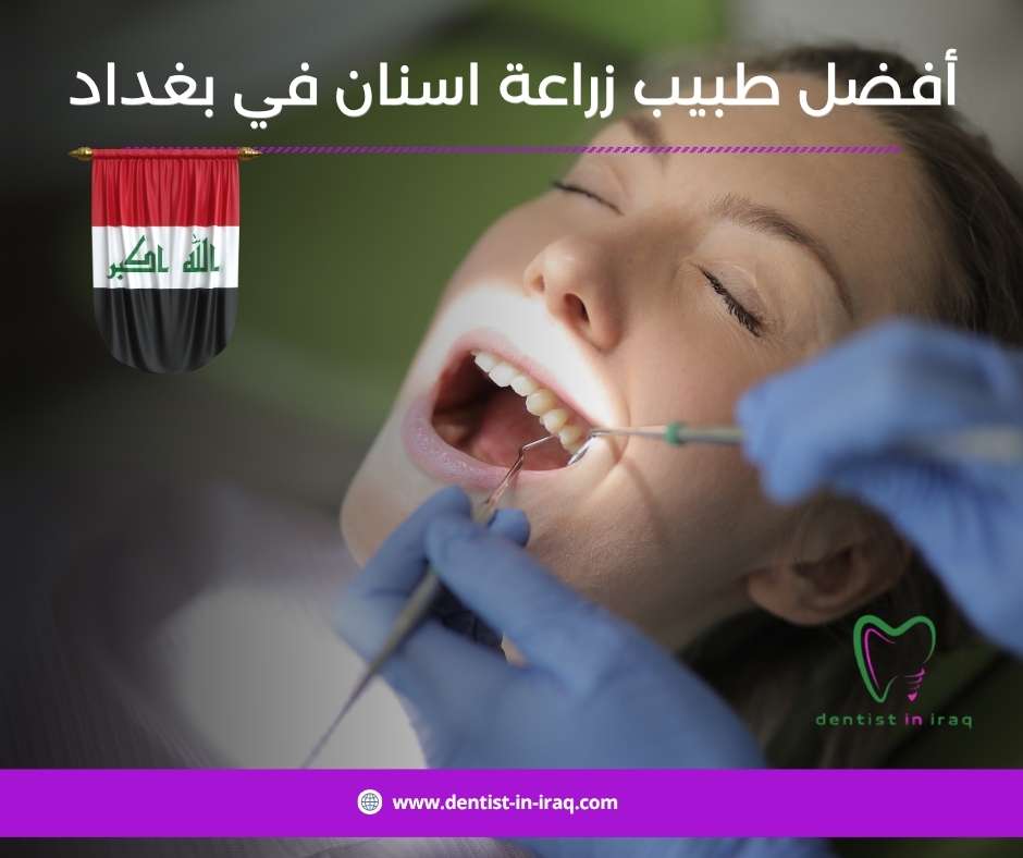 أفضل طبيب زراعة أسنان في بغداد