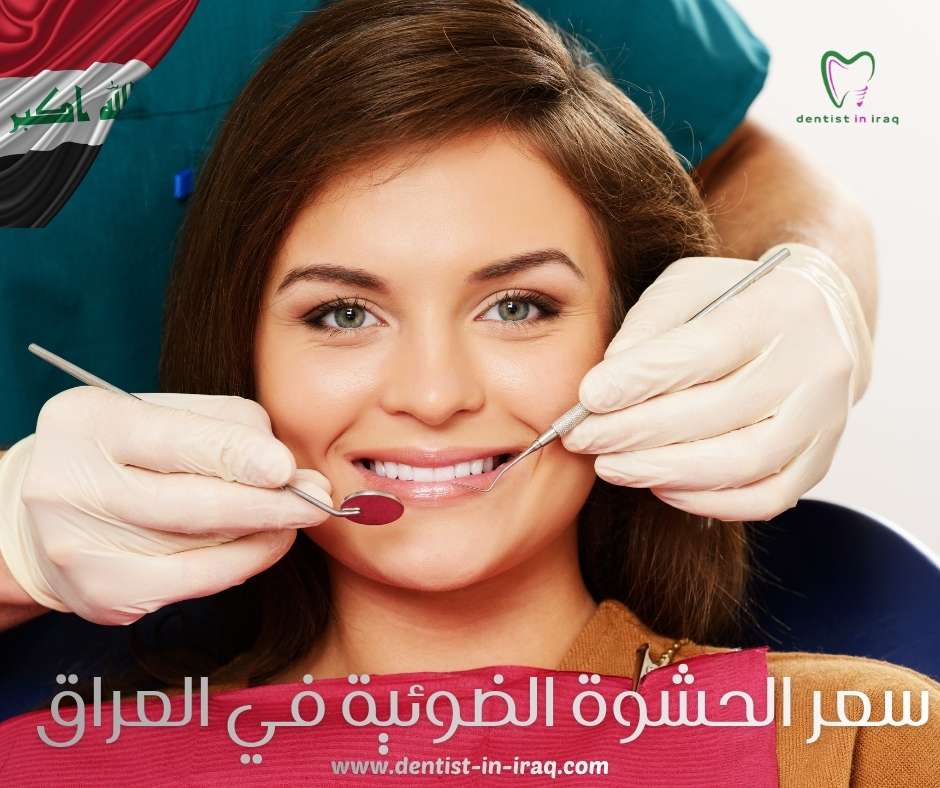 سعر الحشوة الضوئية في العراق