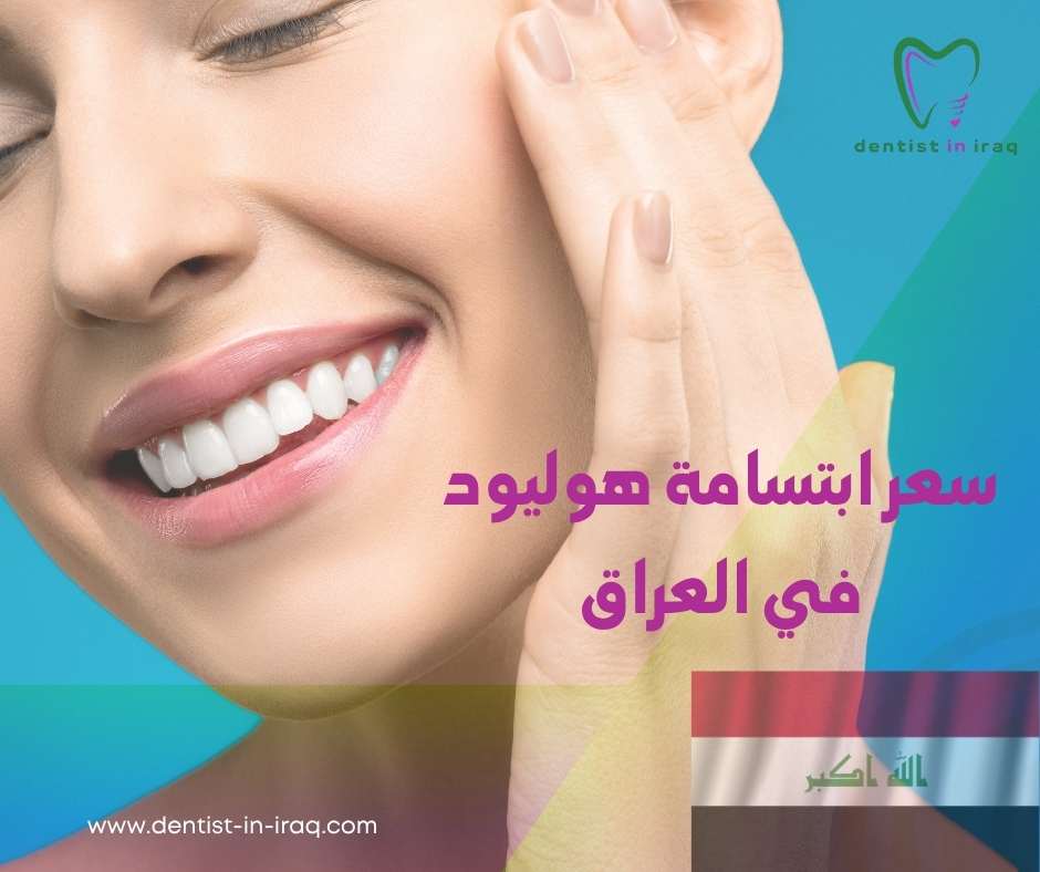 سعر ابتسامة هوليود في العراق