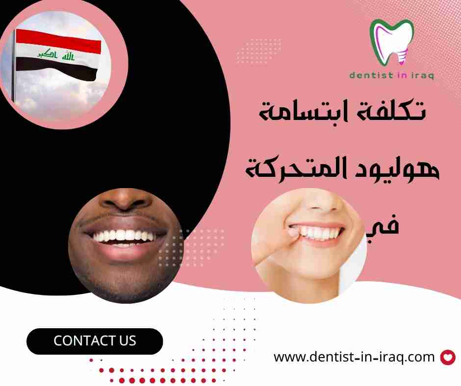 تكلفة ابتسامة هوليود المتحركة في بغداد