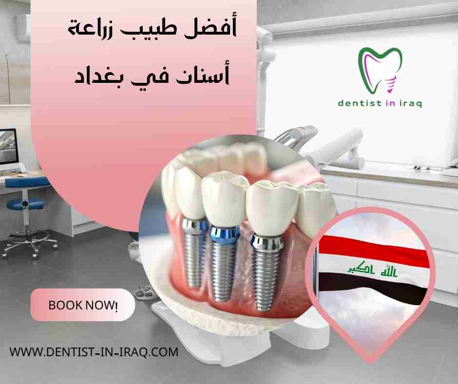 أفضل طبيب زراعة أسنان في بغداد