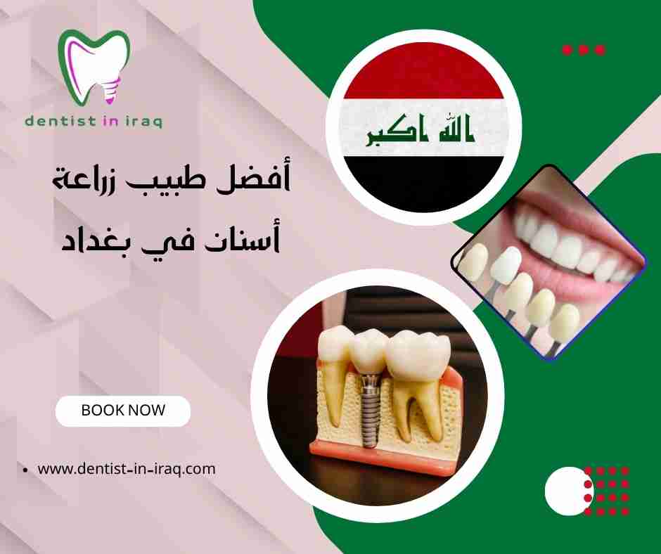 أفضل طبيب زراعة أسنان في بغداد