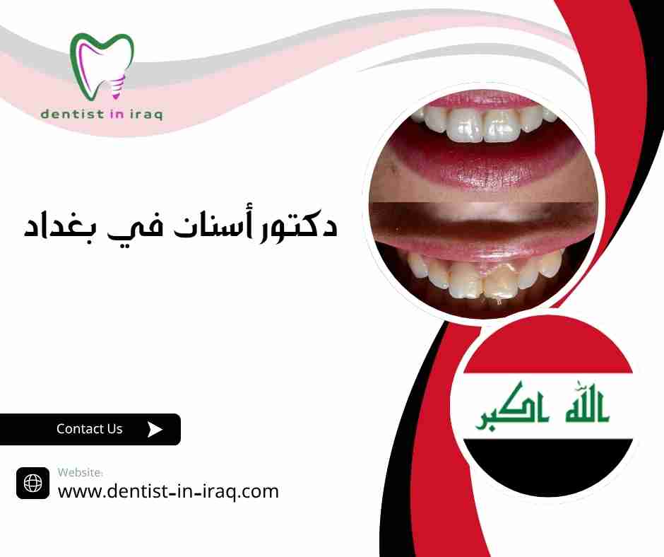 دكتور أسنان في بغداد