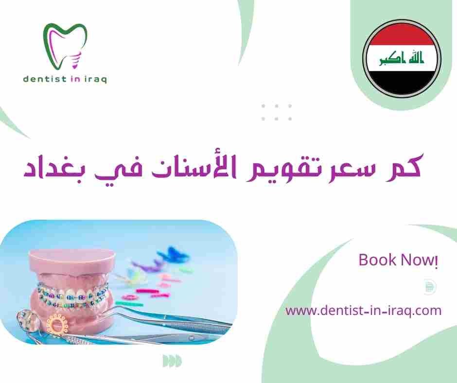 كم سعر تقويم الأسنان في بغداد