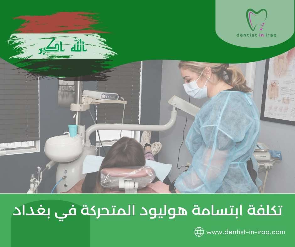 تكلفة ابتسامة هوليود المتحركة في بغداد